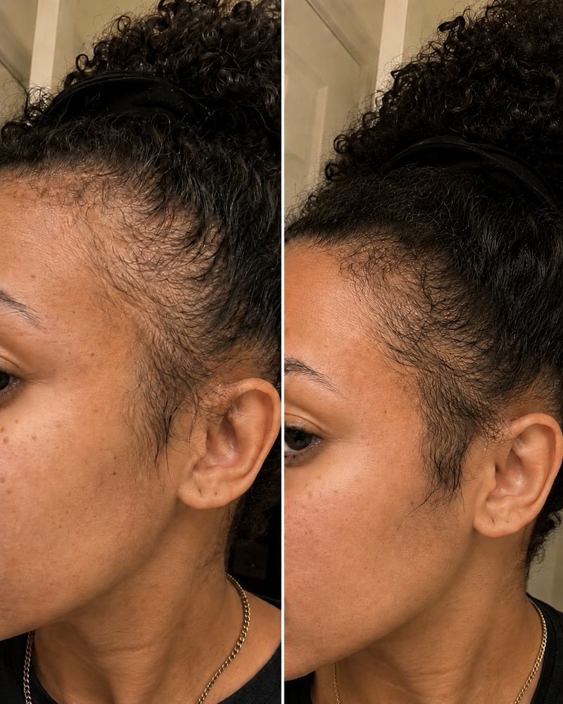 Before and after results