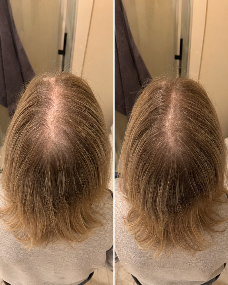 Before and after