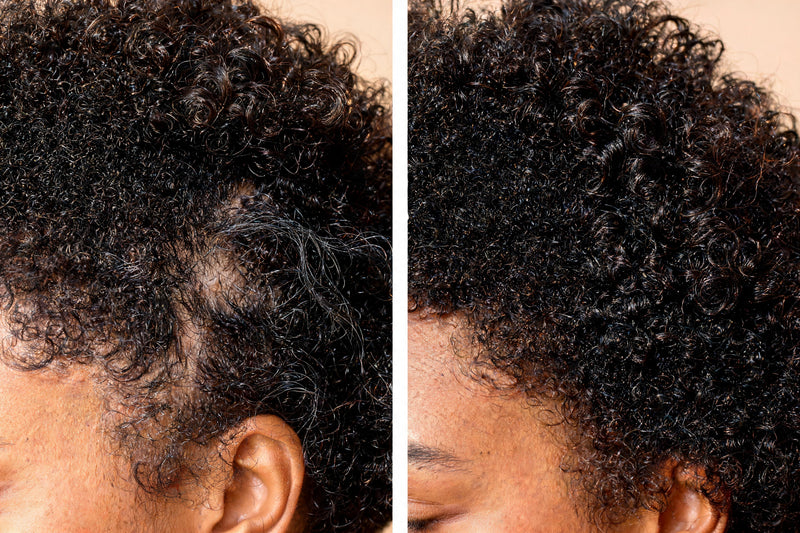 Before and after
