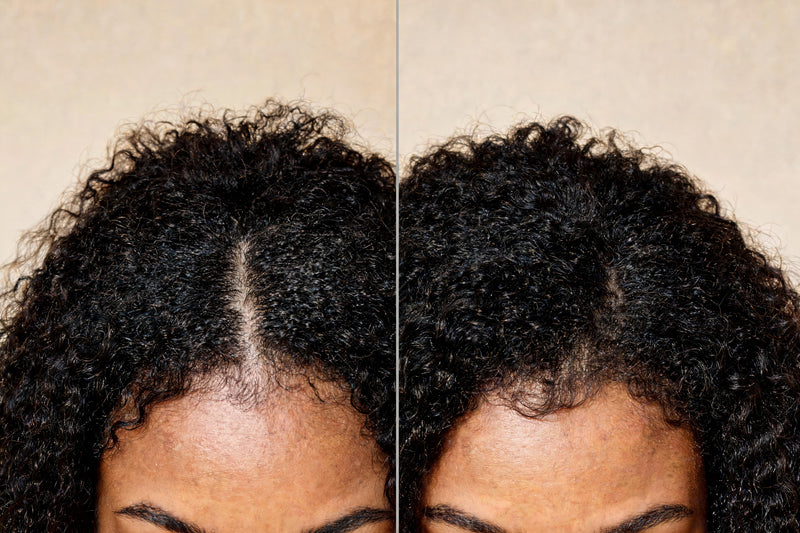 Before and after